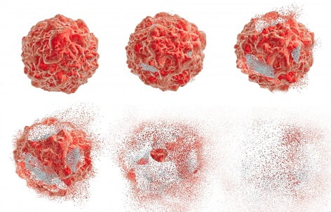 Ling Shen Yao Efektif Untuk Kista Miom Kanker Tumor Endometriosis 9